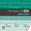 150 Casos de ECG