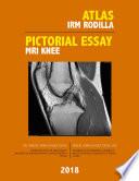 Atlas IRM Rodilla / Pictorial Essay MRI Knee