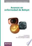 Avances en enfermedad de Behçet