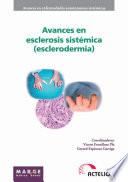 Avances en esclerosis sistémica (esclerodermia)