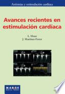 Avances recientes en estimulación cardíaca