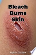 Bleach Burns Skin