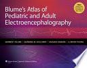 Blume's Atlas of Pediatric and Adult Electroencephalography