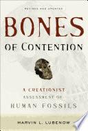 Bones of Contention