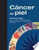 Cancer de Piel