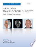 Challenging Concepts in Oral and Maxillofacial Surgery