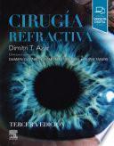 Cirugía Refractiva