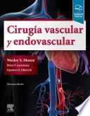 Cirugía vascular y endovascular