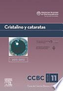 Cristalino y cataratas. 2011-2012