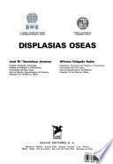Displasias óseas