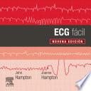 ECG Fácil