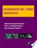 Ecografía del tubo digestivo