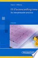 El electrocardiograma