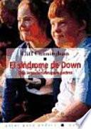 El Sindrome De Down