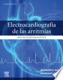 Electrocardiografía de las arritmias
