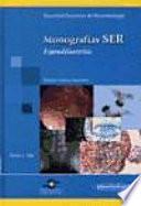 Espondiloartritis