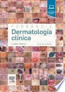 Ferrándiz. Dermatología clínica