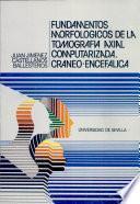 Fundamentos morfológicos de la Tomografía Axial computarizada craneo-encefálica