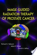 Image-Guided Radiation Therapy of Prostate Cancer