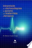 Interpretación del electrocardiograma de pacientes con bradiarritmias y marcapasos