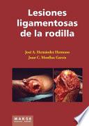 Lesiones ligamentosas de la rodilla