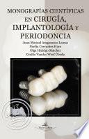 Monografías científicas en cirugía, implantología y periodoncia