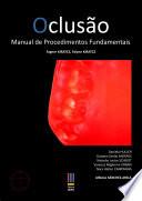 Oclusão