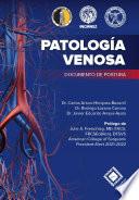 Patología Venosa