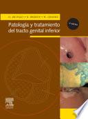 Patología y tratamiento del tracto genital inferior