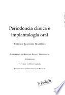 Periodoncia clínica e implantación oral