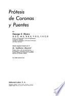 Prótesis de coronas y puentes