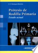 Prótesis de Rodilla Primaria