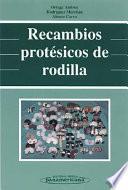Recambios protésicos de rodilla