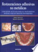 Restauraciones adhesivas no metalicas