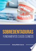 Sobredentaduras.