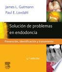 Solución de problemas en endodoncia