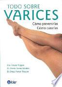 Todo Sobre Varices