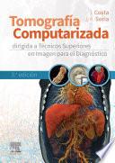 Tomografía computarizada dirigida a técnicos superiores en imagen para el diagnóstico