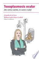 Toxoplasmosis ocular: ¡No coma cuento, ni carne cruda!