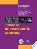 Tratado de ultrasonografía abdominal