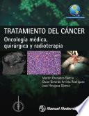 Tratamiento del cáncer