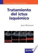 Tratamiento del ictus isquémico