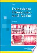 Tratamiento Ortodóntico en el Adulto