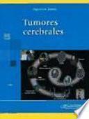 Tumores cerebrales