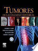 Tumores de la columna vertebral + CD-ROM