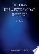 Úlceras de la extremidad inferior. 2a Edición